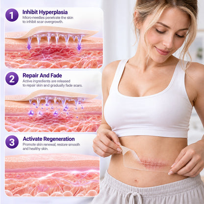 BBOJI® ScarMatrix Hyaluronic Acid Nano Microneedle Repair Tape