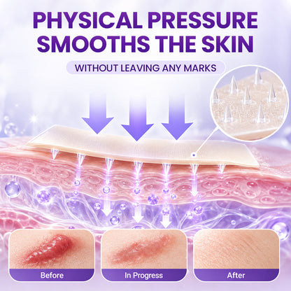 BBOJI® ScarMatrix Hyaluronic Acid Nano Microneedle Repair Tape