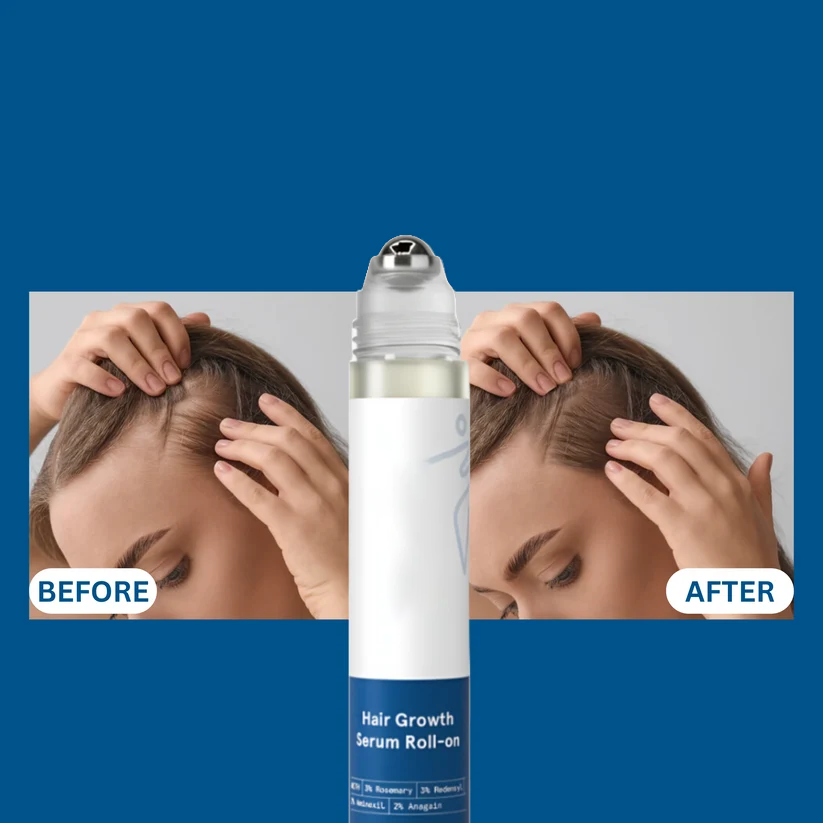 Advanced Hair Density Roll-On Scalp Serum – Saw Palmetto, Rosemary & Caffeine for Fuller-Looking Hair